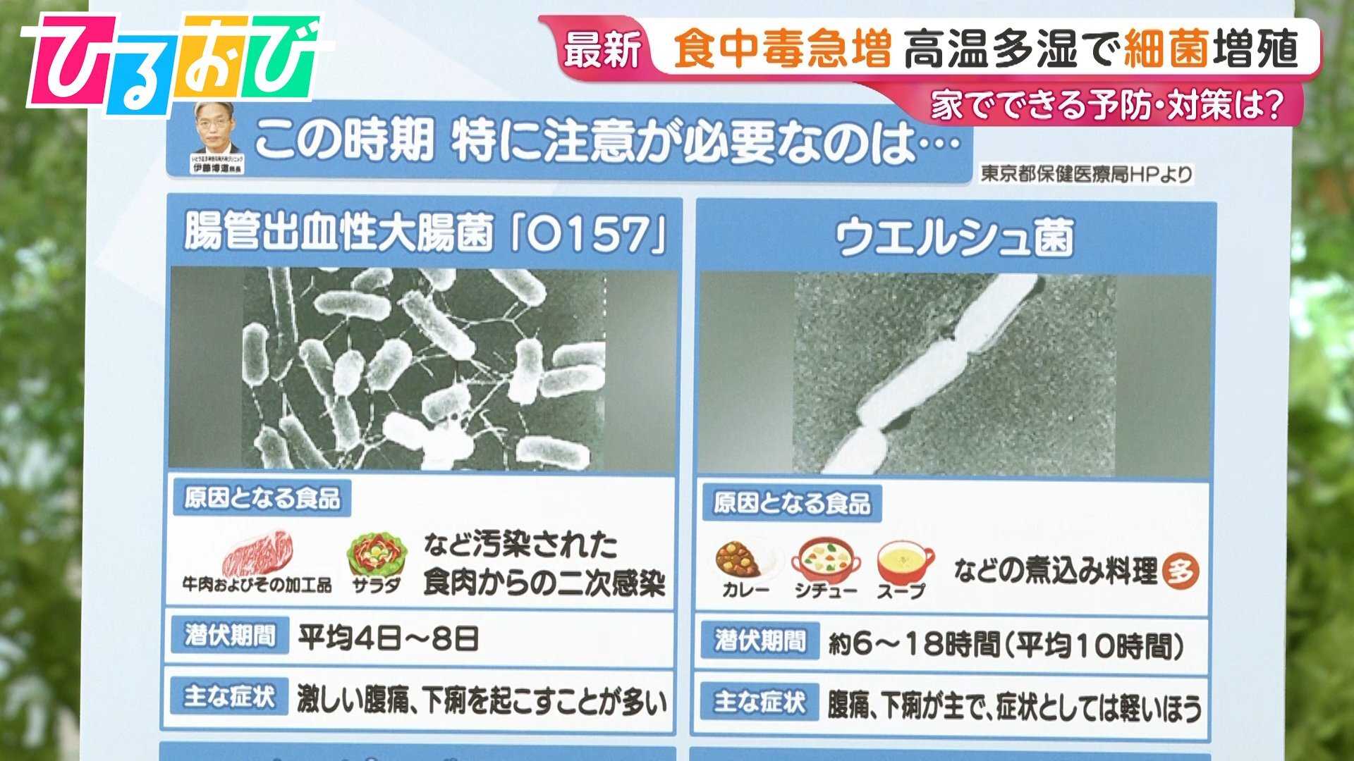 「これって食中毒?」悩んだ時の判断ポイントは…尿が出ない・口がカラカラ 街のギモンに医師が回答【ひるおび】(TBS NEWS DIG Powered by JNN)